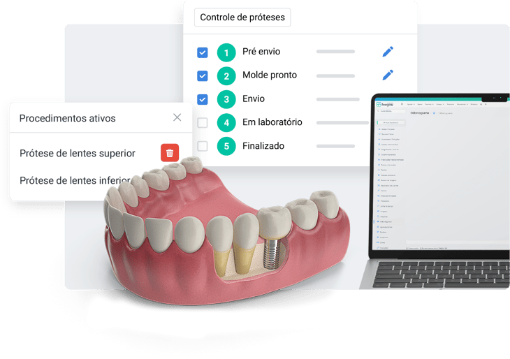 Gestão de próteses Feegow Odonto
